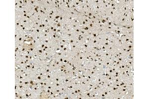 IHC analysis of NOVA2 using anti-NOVA2 antibody (ABIN7599078).
