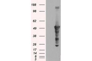 Image no. 1 for anti-Glial Fibrillary Acidic Protein (GFAP) antibody (ABIN1498437) (GFAP antibody)
