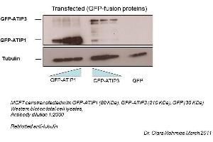 MTUS1 antibody - middle region  validated by WB using MCF-7, HeLa, and human cancer cell lines at 1:2000. (MTUS1 antibody  (Middle Region))