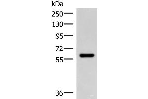 Western blot analysis of Mouse skeletal muscle tissue lysate using MYOT Polyclonal Antibody at dilution of 1:900 (Myotilin antibody)