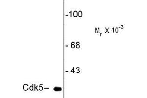 Western Blotting (WB) image for anti-Cyclin-Dependent Kinase 5 (CDK5) antibody (ABIN782438) (CDK5 antibody)