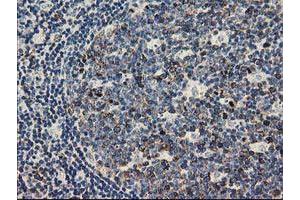 Immunohistochemical staining of paraffin-embedded Human lymph node tissue using anti-TACC3 mouse monoclonal antibody. (TACC3 antibody)