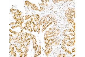 Immunohistochemistry (IHC) image for anti-RNA Polymerase II (pSer5) antibody (ABIN7455032) (RNA Polymerase II antibody  (pSer5))