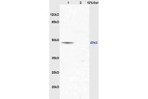 Lane 1: mouse lung lysates Lane 2: mouse stomach lysates probed with Anti EIF5 Polyclonal Antibody, Unconjugated (ABIN1387374) at 1:200 in 4 °C.