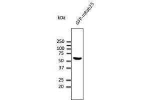 Anti-Rab2S Ab at 1/1,000 dilution, HEK293 cells transfected With GFP-Rab25, rabbit polyclonal to goat lµg (HRP) at 1/10,000 dilution, (RAB25 antibody  (C-Term))