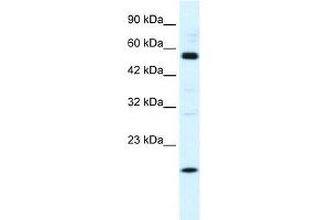 Human HepG2; WB Suggested Anti-ZNF436 Antibody Titration: 1. (ZNF436 antibody  (N-Term))