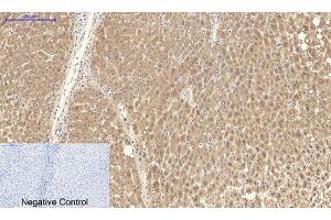 anti-Catalase (CAT) (C-Term) antibody
