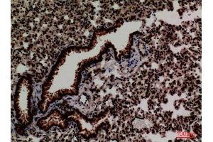 Immunohistochemistry (IHC) analysis of paraffin-embedded Mouse Lung, antibody was diluted at 1:100. (FOXP1 antibody  (C-Term))