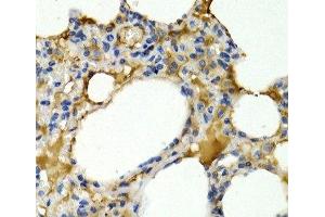 Immunohistochemistry of paraffin-embedded Rat lung using IL9 Polyclonal Antibody at dilution of 1:200 (40x lens). (IL-9 antibody)