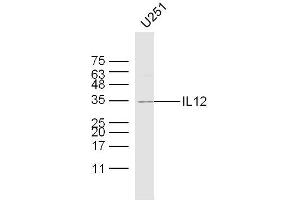 U251 lysates probed with IL12 Polyclonal Antibody, Unconjugated  at 1:300 dilution and 4˚C overnight incubation. (IL12 antibody  (AA 51-150))