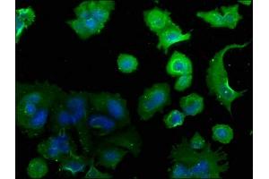Immunofluorescence staining of MCF-7 cells with ABIN7139755 at 1:50, counter-stained with DAPI. (CAMK2N2 antibody  (AA 10-28))