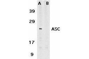 Immunocytochemistry of ASC in HL60 cells with ASC antibody at 5μg/ml. (PYCARD antibody  (C-Term))