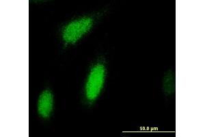 Immunofluorescence of monoclonal antibody to RPS6KA3 on HeLa cell. (RPS6KA3 antibody  (AA 2-95))