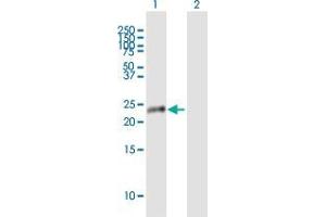 Western Blot analysis of MPV17L expression in transfected 293T cell line by MPV17L MaxPab polyclonal antibody. (MPV17L antibody)