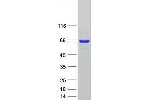 Validation with Western Blot (SETD3 Protein (Transcript Variant 1) (Myc-DYKDDDDK Tag))