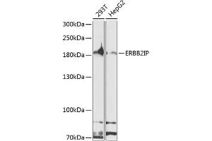 Western blot analysis of extracts of various cell lines, using ERBB2IP antibody (ABIN6127875, ABIN6140250, ABIN6140251 and ABIN6224690) at 1:1000 dilution.