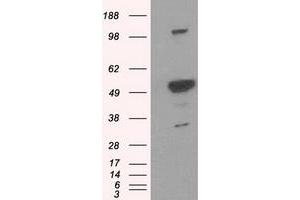 Western Blotting (WB) image for anti-Proteasome (Prosome, Macropain) 26S Subunit, ATPase, 3 (PSMC3) antibody (ABIN1501332) (PSMC3 antibody)