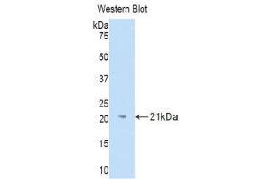 Western Blotting (WB) image for anti-Interleukin 18 Binding Protein (IL18BP) (AA 31-194) antibody (ABIN1859371) (IL18BP antibody  (AA 31-194))