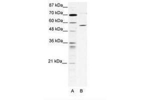 Image no. 1 for anti-Chaperonin Containing TCP1, Subunit 4 (Delta) (CCT4) (AA 453-502) antibody (ABIN202730) (CCT4 antibody  (AA 453-502))
