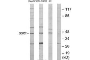 Western blot analysis of extracts from HepG2/Jurkat/COLO205 cells, using SSXT Antibody. (SS18 antibody  (AA 1-50))