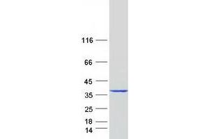Validation with Western Blot