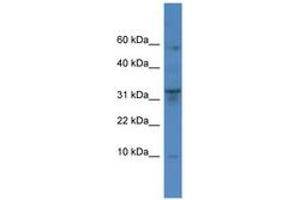 Image no. 1 for anti-Cathepsin C (CTSC) (AA 185-234) antibody (ABIN6746757) (CTSC antibody  (AA 185-234))