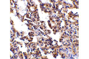 Immunohistochemistry (IHC) image for anti-Interleukin 21 Receptor (IL21R) (Extracellular Domain) antibody (ABIN1030836) (IL21 Receptor antibody  (Extracellular Domain))