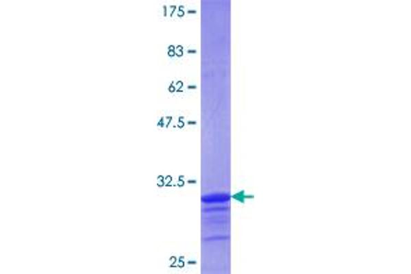 LASS1 Protein (AA 301-350) (GST tag)