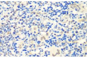 Immunohistochemistry of paraffin-embedded Rat spleen using CTCF Polyclonal Antibody at dilution of 1:200 (40x lens). (CTCF antibody)