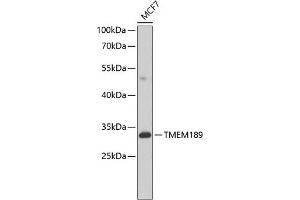 Western blot analysis of extracts of MCF-7 cells, using TMEM189 antibody (ABIN6134447, ABIN6149262, ABIN6149263 and ABIN6224423) at 1:1000 dilution. (TMEM189 antibody  (C-Term))