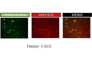 Sample Type: P48 Mouse Dilution: 1:2000 tested with brain slices in Immunohistochemistry