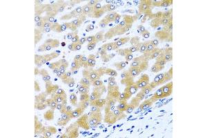 Immunohistochemistry of paraffin-embedded human liver using CCL21 antibody (ABIN5970974) at dilution of 1/100 (40x lens). (CCL21 antibody)