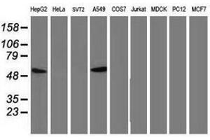 Image no. 5 for anti-Tumor Protein P53 (TP53) antibody (ABIN1499968) (p53 antibody)