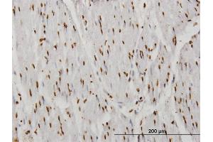 Immunoperoxidase of monoclonal antibody to TAF11 on formalin-fixed paraffin-embedded human smooth muscle.