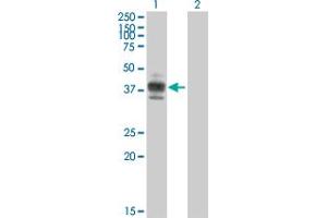 Western Blot analysis of CD2 expression in transfected 293T cell line by CD2 MaxPab polyclonal antibody. (CD2 antibody  (AA 1-351))