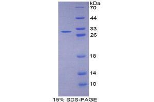 SDS-PAGE (SDS) image for Fibulin 1 (FBLN1) (AA 176-398) protein (His tag) (ABIN1170445)