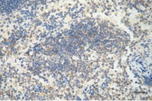 Immunohistochemistry was performed on paraffin-embedded mouse spleen using AIFM1 antibody (ABIN7797632), 1:200).