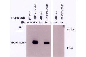 Image no. 1 for anti-Nephronophthisis 1 (Juvenile) (NPHP1) antibody (ABIN264966) (NPHP1 antibody)