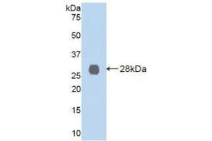 Detection of Recombinant LOXL2, Human using Polyclonal Antibody to Lysyl Oxidase Like Protein 2 (LOXL2) (LOXL2 antibody  (AA 544-751))