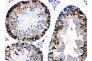 nti- Stathmin 1 Picoband antibody, IHC(P) IHC(P): Mouse Testis Tissue (Stathmin 1 antibody  (N-Term))