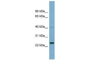 WB Suggested Anti-HSPC111 Antibody Titration: 0. (NOP16 antibody  (Middle Region))