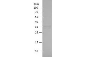 Western Blotting (WB) image for Cyclin-Dependent Kinase 1 (CDK1) (AA 179-297) protein (His-IF2DI Tag) (ABIN7122525) (CDK1 Protein (AA 179-297) (His-IF2DI Tag))