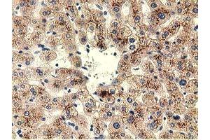 Immunohistochemical staining of paraffin-embedded Human liver tissue using anti-THOP1 mouse monoclonal antibody. (Thimet Oligopeptidase 1 antibody)