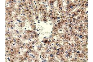 Immunohistochemical staining of paraffin-embedded Human liver tissue using anti-THOP1 mouse monoclonal antibody.