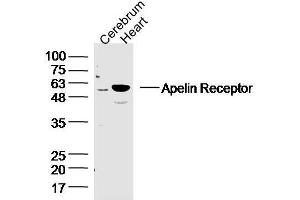 Mouse cerebrum and heart lysates probed with APJ Receptor Polyclonal Antibody, unconjugated  at 1:300 overnight at 4°C followed by a conjugated secondary antibody at 1:10000 for 90 minutes at 37°C. (Apelin Receptor antibody  (AA 52-66))