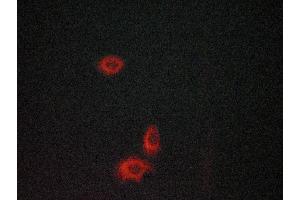 Immunofluorescence (fixed cells) (IF/ICC) image for anti-Nuclear Factor of kappa Light Polypeptide Gene Enhancer in B-Cells Inhibitor, alpha (NFKBIA) (N-Term) antibody (ABIN6262504)