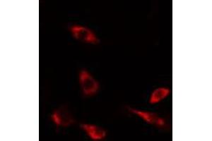 ABIN6274489 staining HeLa cells by IF/ICC. (DUSP9 antibody  (Internal Region))