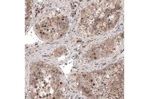 Immunohistochemical staining (Formalin-fixed paraffin-embedded sections) of human testis shows moderate cytoplasmic immunoreactivity in seminiferous tubules cells. (Usp30 antibody)