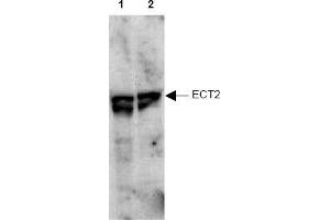 Image no. 1 for anti-Epithelial Cell Transforming Sequence 2 Oncogene (ECT2) (AA 785-795), (pThr790) antibody (ABIN401345) (ECT2 antibody  (pThr790))