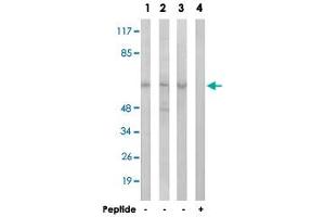 Western blot analysis of extracts from HeLa cells (Lane 1), Jurkat cells (Lane 2) and A-549 cells (Lane 3 and lane 4), using AGBL4 polyclonal antibody . (AGBL4 antibody)